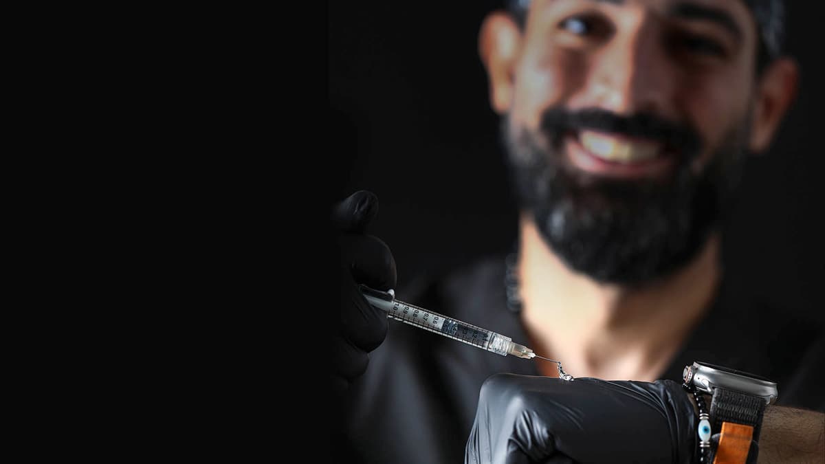 filler-treatment-rami