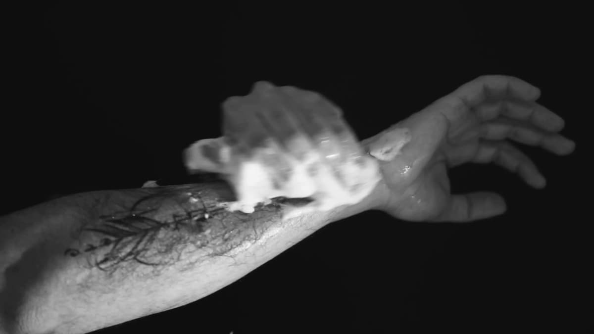 surgical-wash-hands