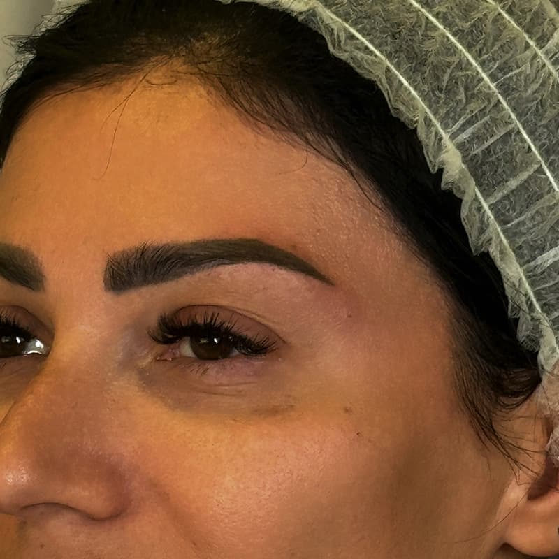 dubai-surgery-lifting