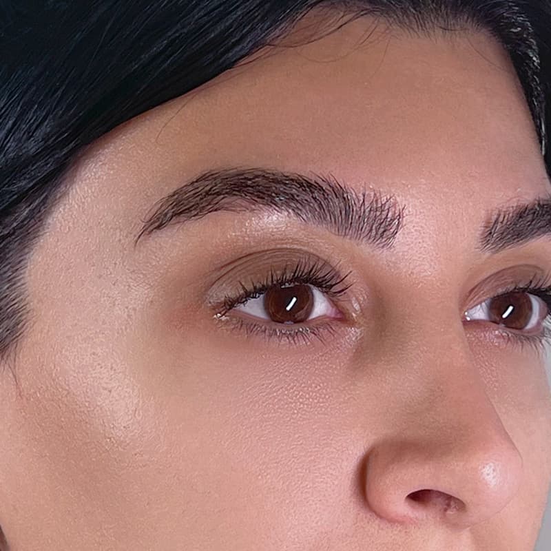 eyelifting-brow