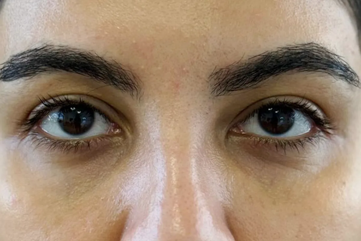 salmon-dna-after3weeks