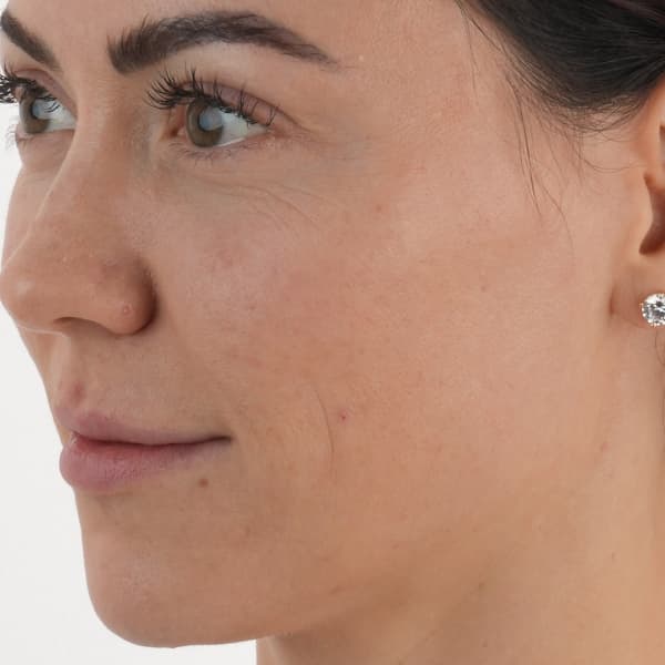 case-two-before-side