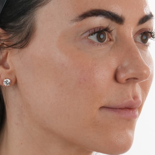 case-2-after-glassskin