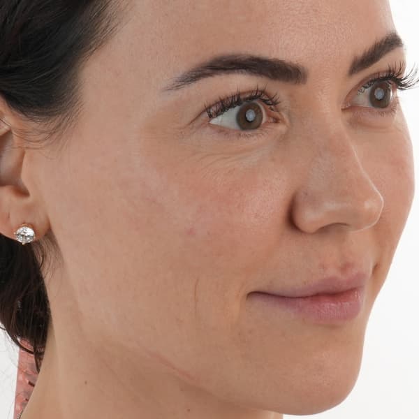 case-2-before-glassskin