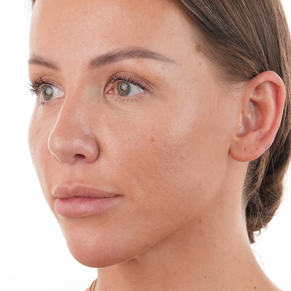 before-glass-skin-1