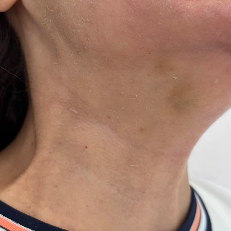 signature-treatments-neck