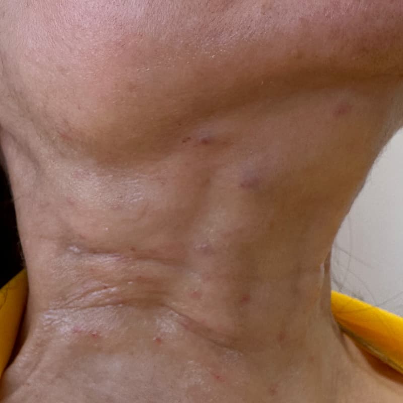 neck-treatments-signature